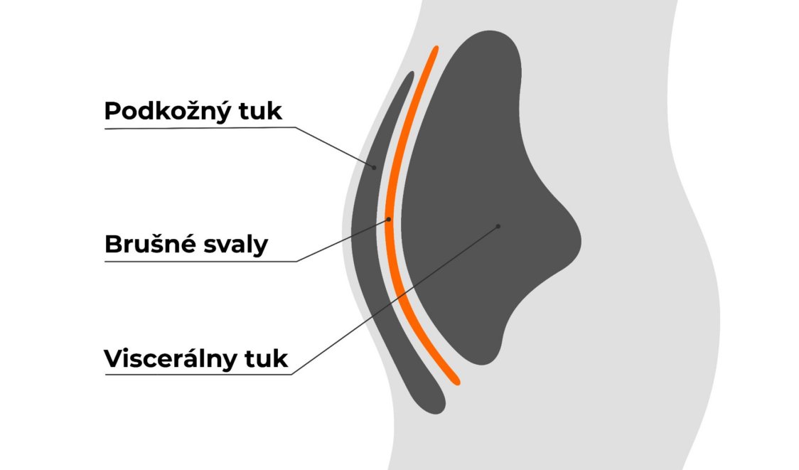 Subkutan- und Viszeralfett
