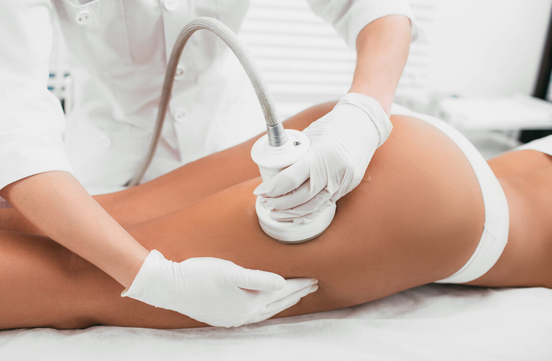 Verfahren zur Behandlung von Cellulite