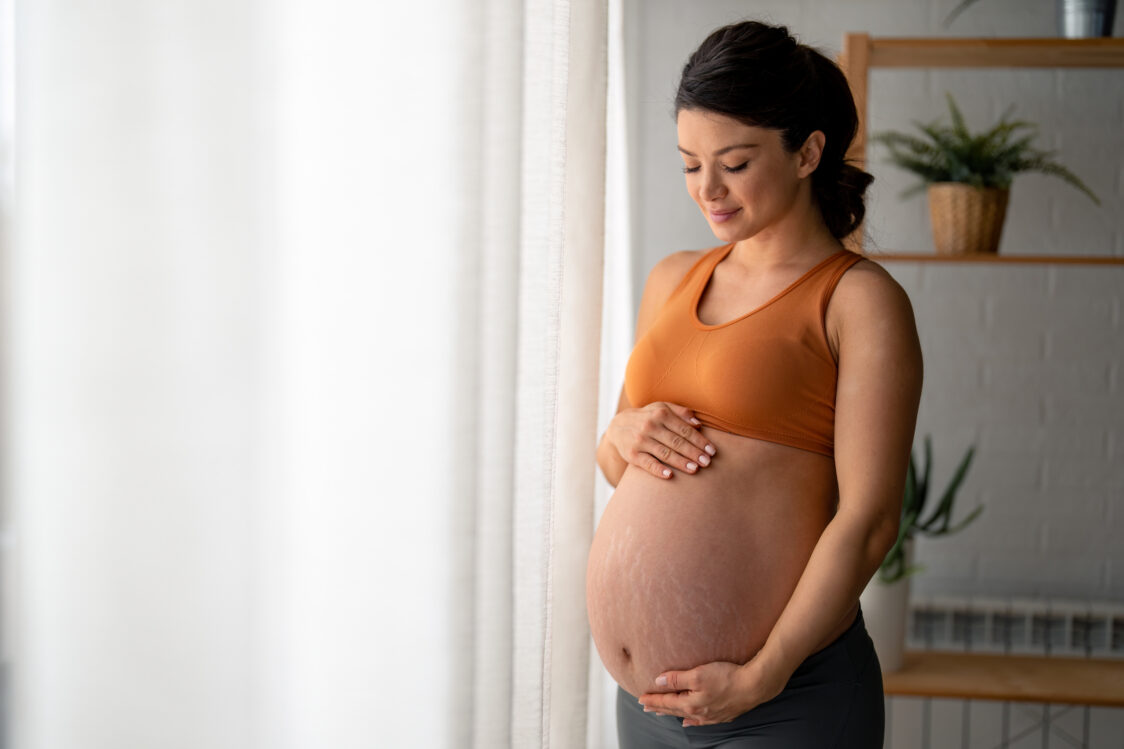 Was sind Dehnungsstreifen?